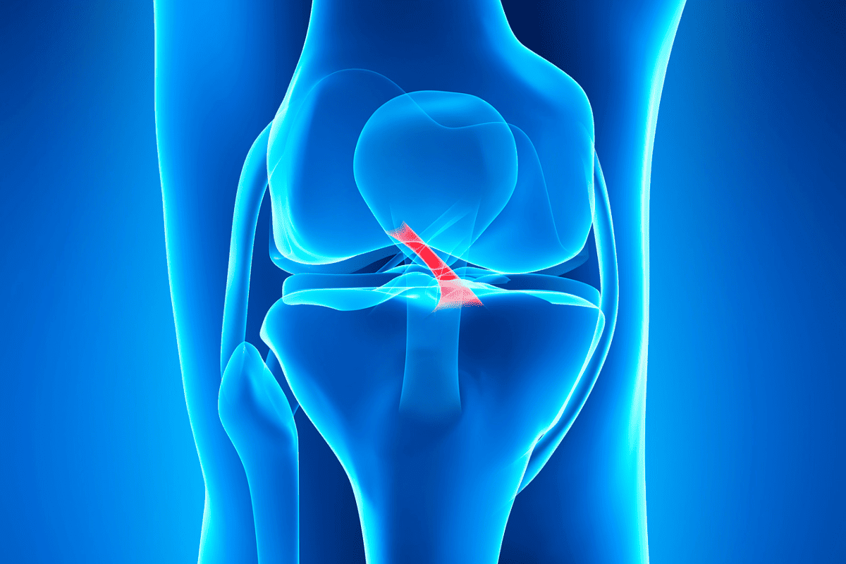 Rupturile de ligament încrucișat anterior